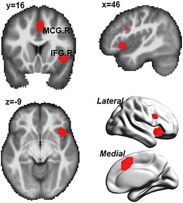 Inhibitory Control in Aging: The Compensation-Related Utilization of Neural Circuits Hypothesis